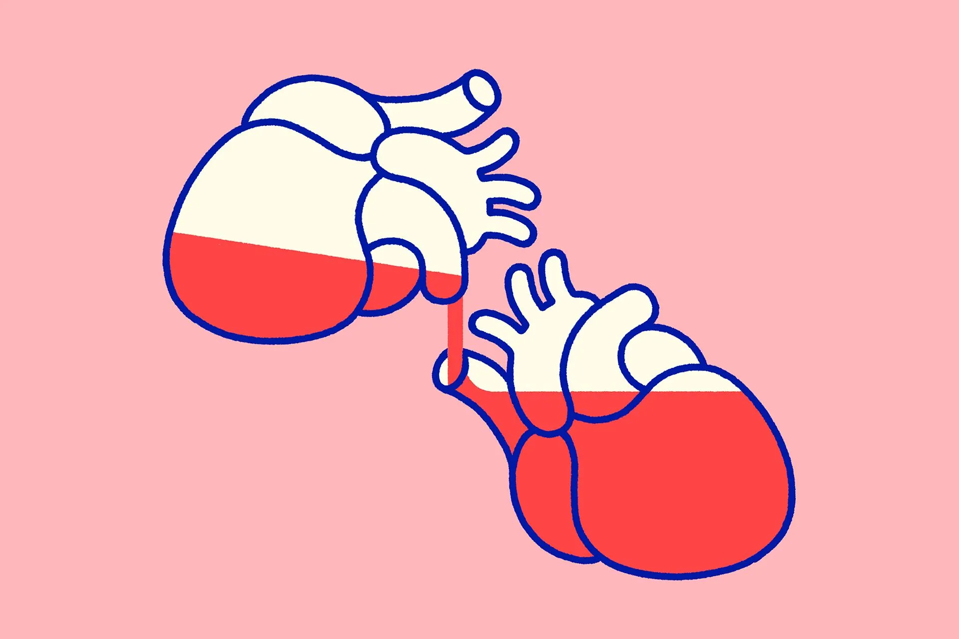 Organ donation